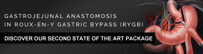 Gastrojejunal anastomosis in roux-en-y gastric bypass (RYGB)