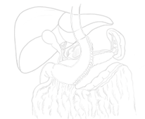 bariatric