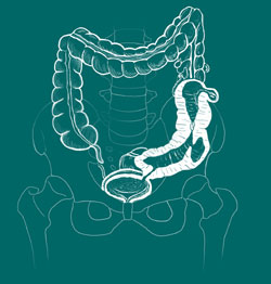 colorectal