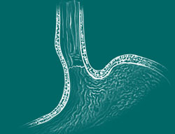 esophago