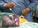 Videos of live surgery