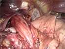 Videos of live surgery