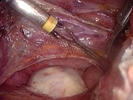 Videos of live surgery